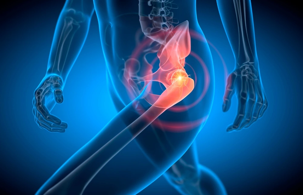 hip replacement surgery procedure